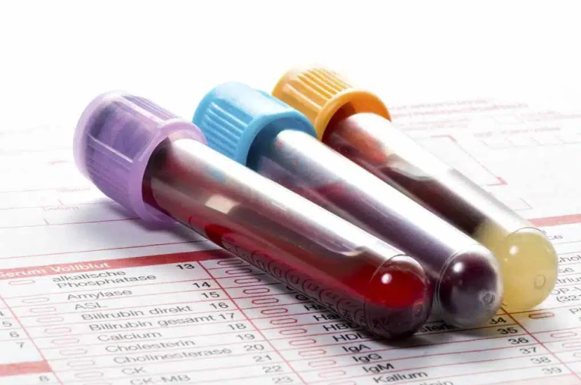 Simple Blood Test Could Predict Long-Term Heart Disease Risk